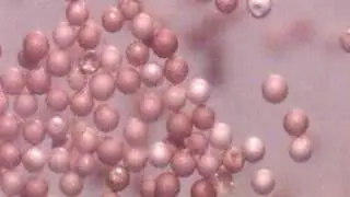 HYDRATING SEA MONKEY EGGS TIME LAPSE PHOTOMICROGRAPHIC FILMS