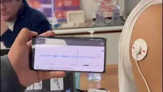Medicion EMG triceps en movimiento
