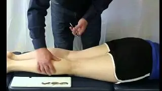 Myobar   #1 Diagnostic Stroke   2M