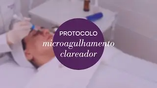 Protocolo Microagulhamento Clareador