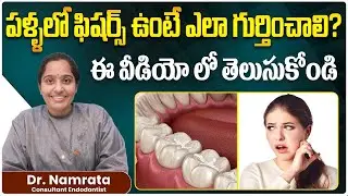 Understanding Pits and Fissures on Teeth in Telugu || Causes of Fissures on Teeth || Eledent Dental