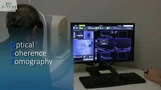 Présentation du service d'ophtalmologie du CHU de Nîmes