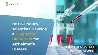 HKUST Neuroscientists Develop a Diagnostic Blood Test for Alzheimer&rsquo;s Disease