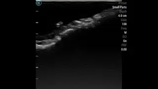 Ultrasound Scanning Results of Rat Phantom