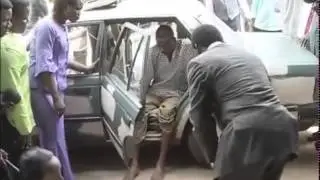 TB Joshua Healing Broken Bones