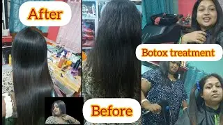 রাত্রি 9 টার সময় Botox treatment করতে গেলাম।।