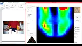 Precision's PS 256 Pressure Mapping Clinical Tutorial - Wheelchair Seating