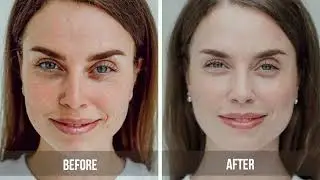 FORLLE'D | BEFORE & AFTER