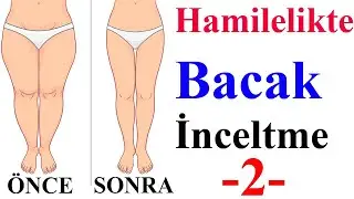 Hamilelikte Bacak İnceltme -2