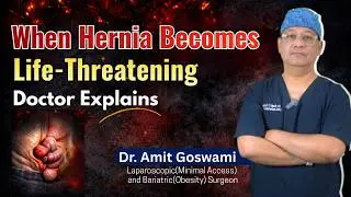 When Hernia Becomes Life-Threatening | Hernia Warning Signs