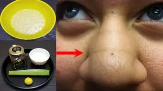 Did you get rid of dark line? Here we have the solution | هل تخلصت من الخط المظلم؟ هنا لدينا الحل