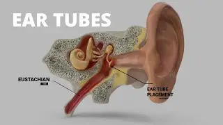Ear Tubes with Dr. Raymond Brown - Capital ENT