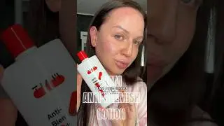 TIAM Anti-Blemish Body Lotion #tiam #tiamglow #keratosispilaris #bodyacne #backacne #koreanskincare