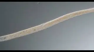 Ciliate spirostomum 200x