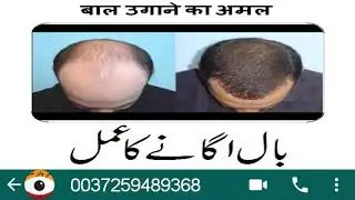 SAR K BAL UGANE KA AMAL | NOORANI | KHUWABO KI DUNYA @BengaliJadoAmliyatClientsWork | ROOHANI ILAJ