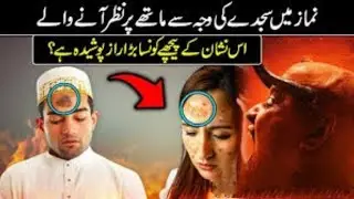 Strange Truth Behind The Mark of Prostration (سجدہ) On the Forehead