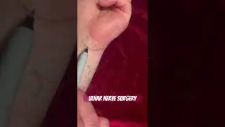 Ulnar Nerve Surgery #blues #guitarist #overcomingchallenges #motivation #music