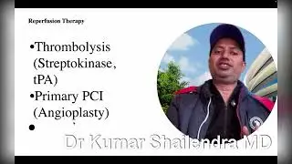 Acute MI# heart attack Kumar Shailendra 