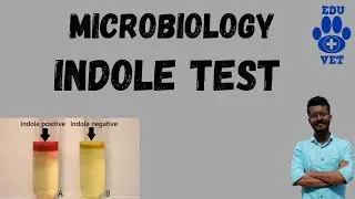 Indole Test-Microbiology