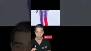 Orthopedic surgeon discusses deep vein thrombosis and blot clots as well as pulmonary embolus