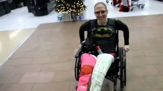batgirl's two ful leg casts