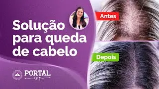 Acabe com a QUEDA DE CABELO e tenha mais saúde capilar com esse óleo essencial | OE#09