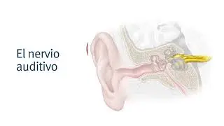 ¿Cuál es la causa de la pérdida auditiva?