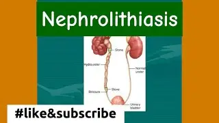 Kidney stones,Nephrolithiasis,Causes,Types,clinical diagonal all in one Shot#views #biology #fypシ 