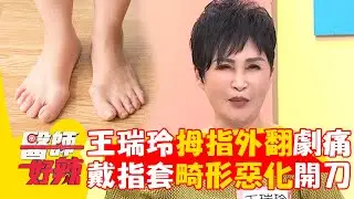 王瑞玲拇指外翻摩擦劇痛！戴矯正指套「加速畸形惡化」只能開刀治療？！【#醫師好辣】20240728 EP1652 part3