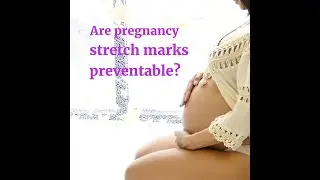 Stretch Marks: Causes & Treatment Options