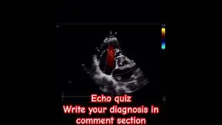 #echocardiography #echo #cardiology #hearttest #heartmonitoring @SafaMedicalLecture
