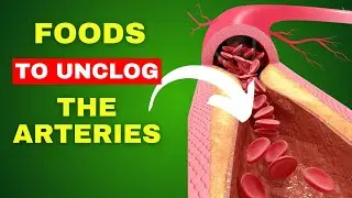15 Foods to Unclog Your Arteries and Help Prevent Heart Attack