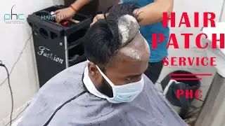 Hair Patch in Delhi | Hair Patch Service in Delhi | PHC Team Call Now 9899746489