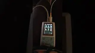 24 hours blood pressure with pulmonic Sounds