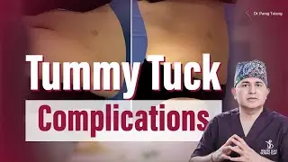 Tummy Tuck Complications Explained: Risks, Prevention & Aftercare Tips | Dr. Parag Telang