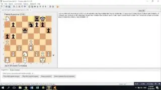 My First Immortal Game