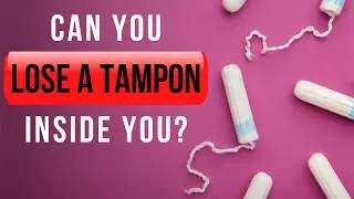 Может ли тампон потеряться внутри? Врач объясняет, что делать, если вы забыли вытащить тампон.