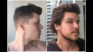 4 Month Hair Growth Update | Probably Hairier Than Your Dad