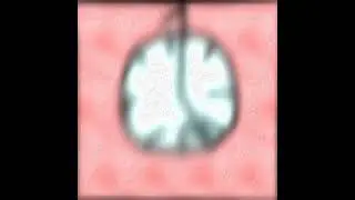 The Carementor - Decaying at the end of Life - Stage 1