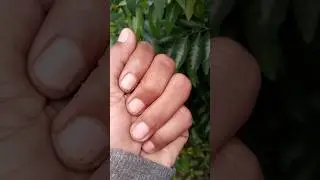 one of the beautiful ladybugs