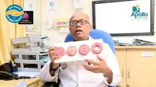Patient Family Education On Asthma Care