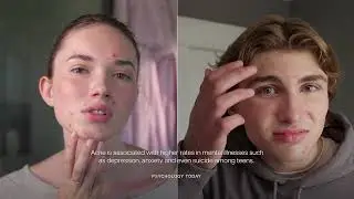 Introducing the Skin Laundry Teen Acne Program