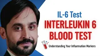 IL-6 Test | Interleukin 6 Blood Test | MLT Hub with kamran