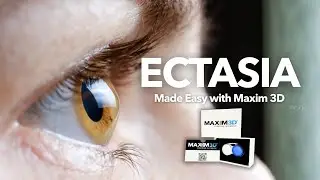 Perfect Scleral Lens Fitting for Post-Surgery Eyes