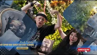 植毛患者満足度の重要性