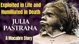 Julia Pastrana’s Heartbreaking Story You’ve Never Heard #biography #history
