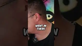 Man Shot Himself In The Head & Survived