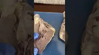 Sheep heart Dissection Practical