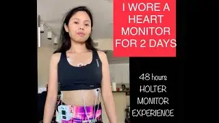Wearing a HEART MONITOR for 2 days || 48 hours HOLTER monitor experience