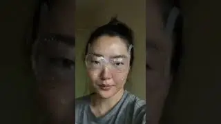 JUST GOT EYE SURGERY... THE RESULT AFTER ICL...
